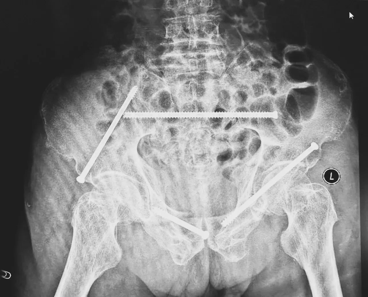 1751958915641435.jpeg 1751958915641435.jpeg